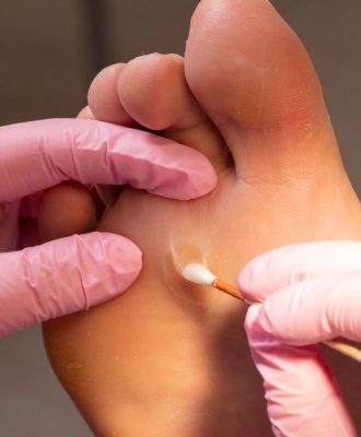 The,Hands,Of,An,Unrecognizable,Female,Podiatrist,With,Pink,Gloves